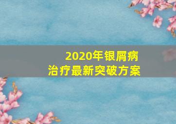 2020年银屑病治疗最新突破方案