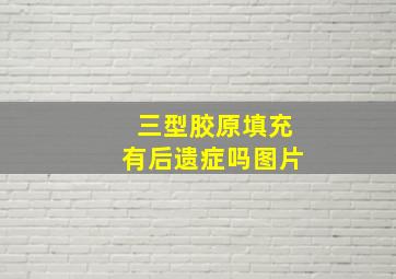 三型胶原填充有后遗症吗图片