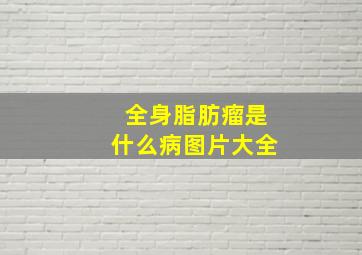 全身脂肪瘤是什么病图片大全