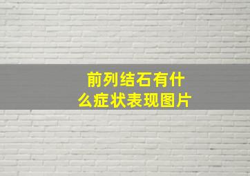 前列结石有什么症状表现图片