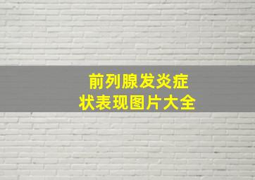 前列腺发炎症状表现图片大全