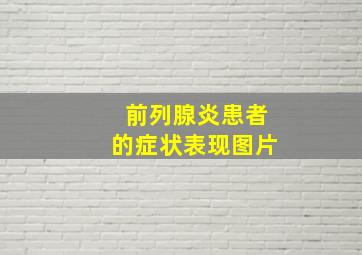 前列腺炎患者的症状表现图片