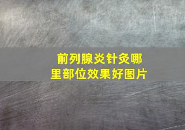 前列腺炎针灸哪里部位效果好图片