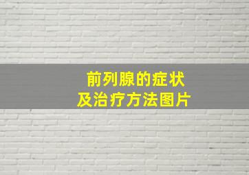 前列腺的症状及治疗方法图片