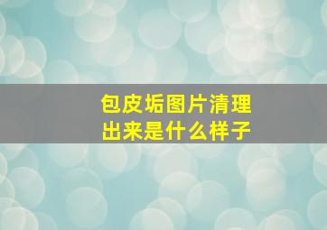 包皮垢图片清理出来是什么样子