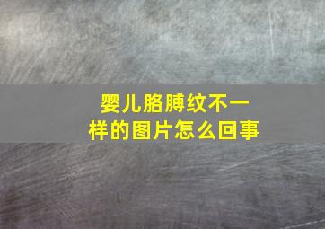 婴儿胳膊纹不一样的图片怎么回事