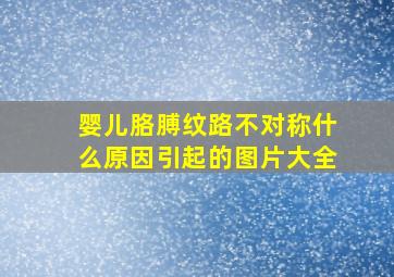 婴儿胳膊纹路不对称什么原因引起的图片大全