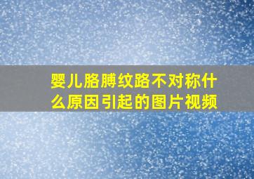 婴儿胳膊纹路不对称什么原因引起的图片视频