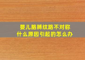 婴儿胳膊纹路不对称什么原因引起的怎么办