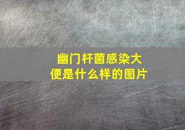 幽门杆菌感染大便是什么样的图片