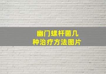 幽门螺杆菌几种治疗方法图片