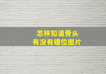 怎样知道骨头有没有错位图片