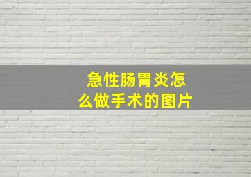 急性肠胃炎怎么做手术的图片