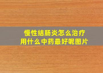 慢性结肠炎怎么治疗用什么中药最好呢图片