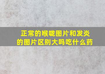 正常的喉咙图片和发炎的图片区别大吗吃什么药