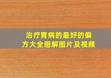 治疗胃病的最好的偏方大全图解图片及视频