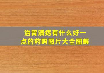 治胃溃疡有什么好一点的药吗图片大全图解