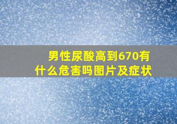 男性尿酸高到670有什么危害吗图片及症状