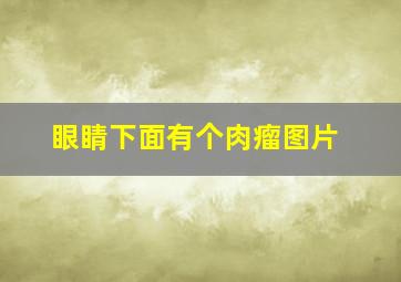 眼睛下面有个肉瘤图片