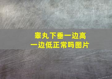 睾丸下垂一边高一边低正常吗图片