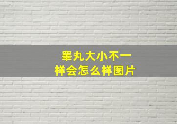 睾丸大小不一样会怎么样图片