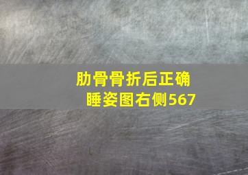 肋骨骨折后正确睡姿图右侧567