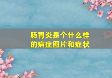 肠胃炎是个什么样的病症图片和症状