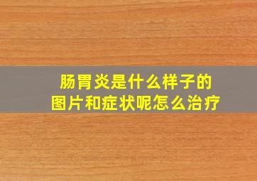 肠胃炎是什么样子的图片和症状呢怎么治疗