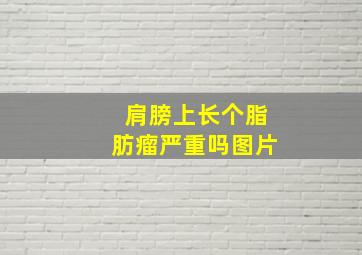 肩膀上长个脂肪瘤严重吗图片