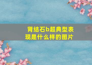 肾结石b超典型表现是什么样的图片