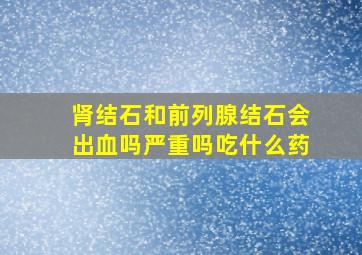 肾结石和前列腺结石会出血吗严重吗吃什么药