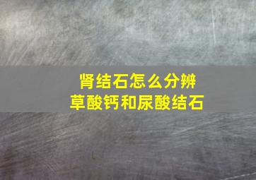 肾结石怎么分辨草酸钙和尿酸结石