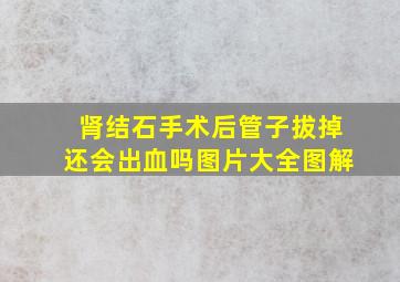 肾结石手术后管子拔掉还会出血吗图片大全图解