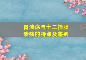 胃溃疡与十二指肠溃疡的特点及鉴别