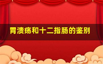 胃溃疡和十二指肠的鉴别