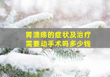 胃溃疡的症状及治疗需要动手术吗多少钱