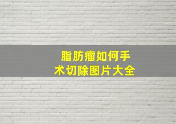 脂肪瘤如何手术切除图片大全