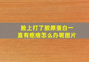 脸上打了胶原蛋白一直有疙瘩怎么办呢图片