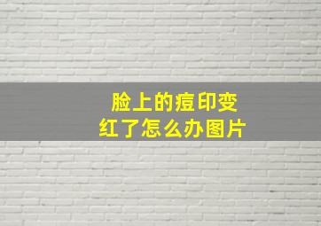 脸上的痘印变红了怎么办图片