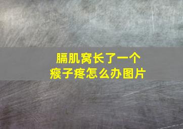 膈肌窝长了一个瘊子疼怎么办图片