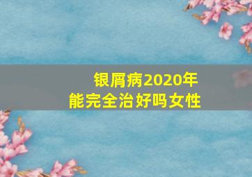 银屑病2020年能完全治好吗女性