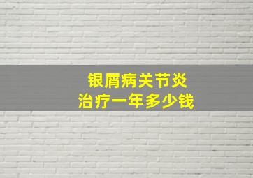 银屑病关节炎治疗一年多少钱