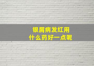 银屑病发红用什么药好一点呢