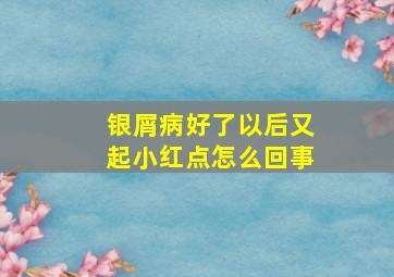 银屑病好了以后又起小红点怎么回事