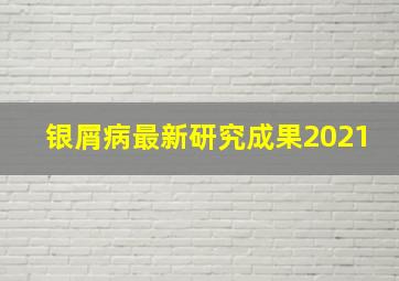 银屑病最新研究成果2021