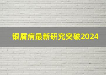 银屑病最新研究突破2024