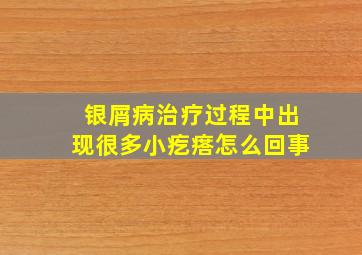 银屑病治疗过程中出现很多小疙瘩怎么回事