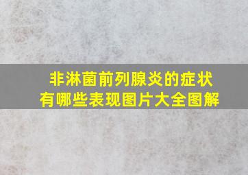 非淋菌前列腺炎的症状有哪些表现图片大全图解