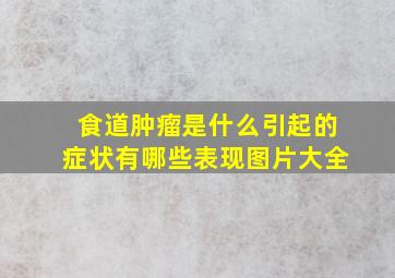 食道肿瘤是什么引起的症状有哪些表现图片大全