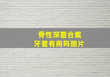 骨性深覆合戴牙套有用吗图片